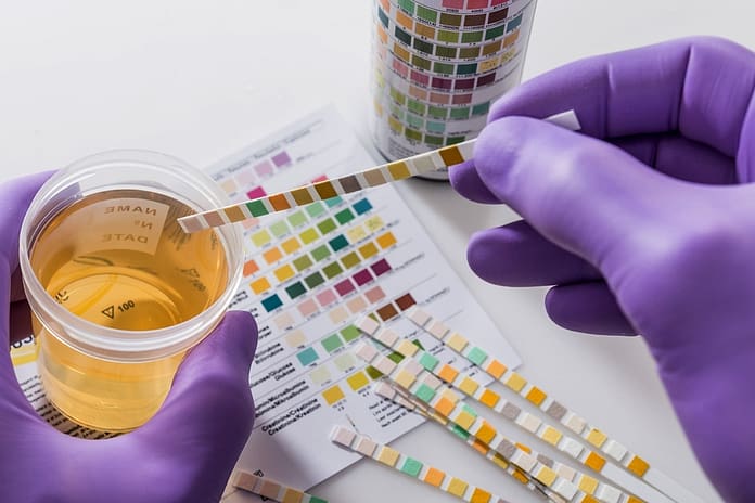 drug screens