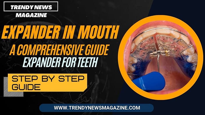 Expander in Mouth