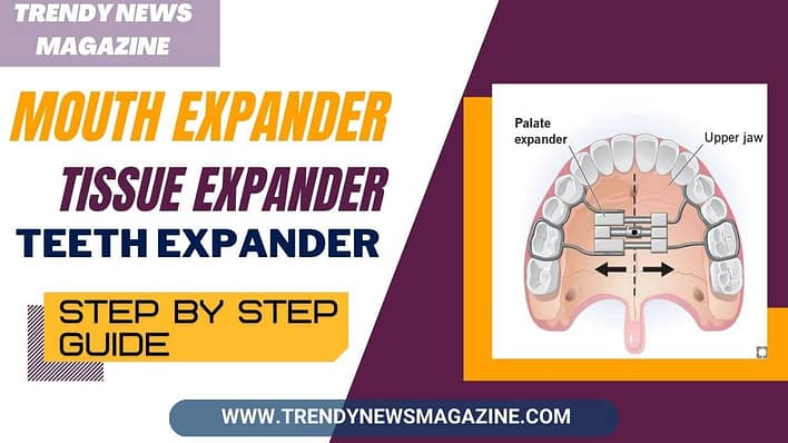 Mouth Expander