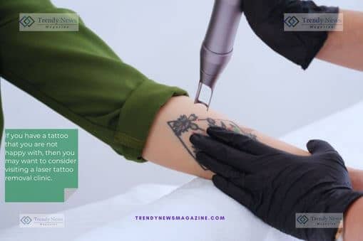 A Tattoo Removal Clinic Can Help You Get Rid of Your Unwanted Artwork